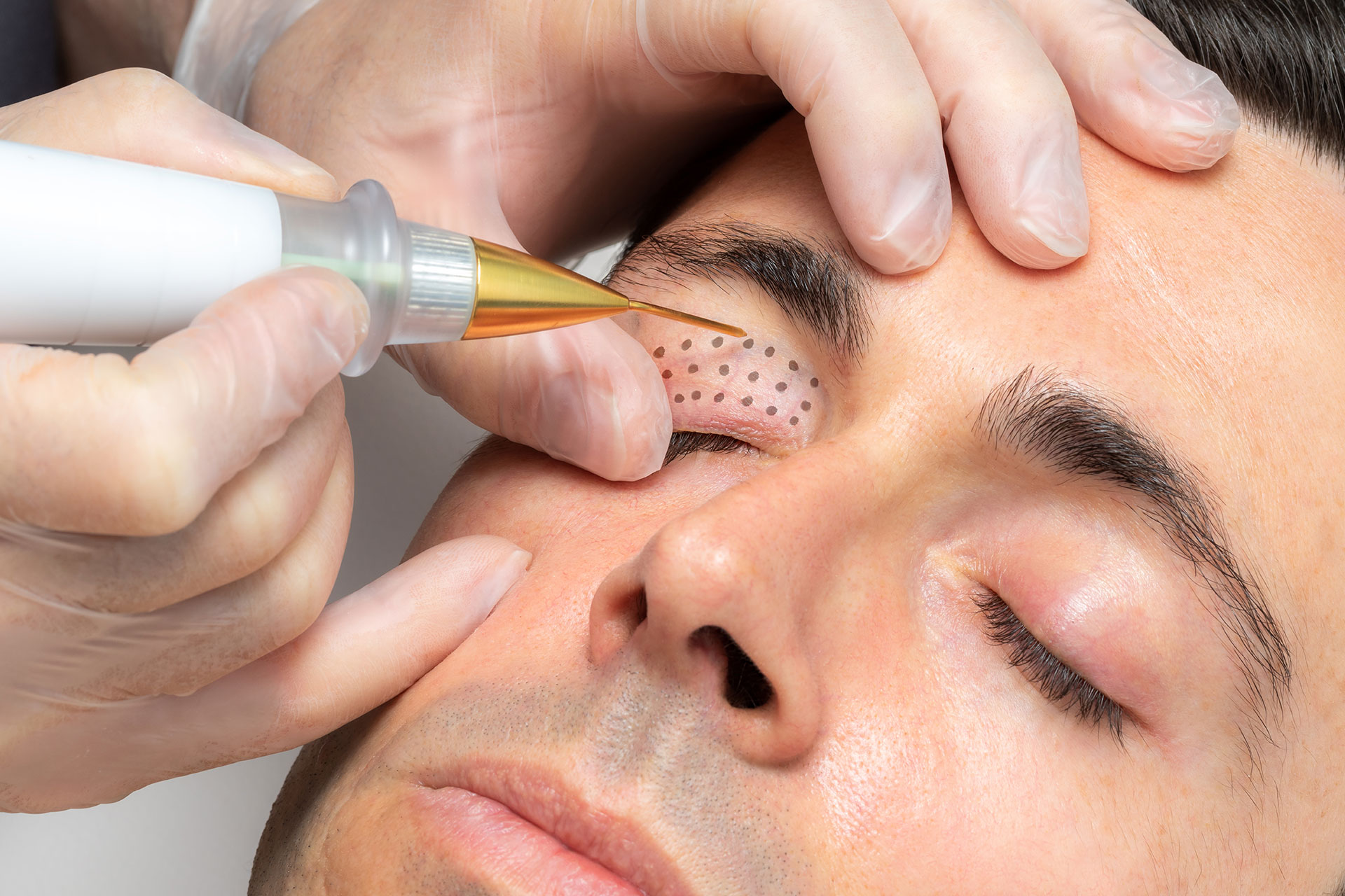 dermiplas Dermiplas